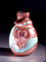 Vase mit Türkenbundlilie